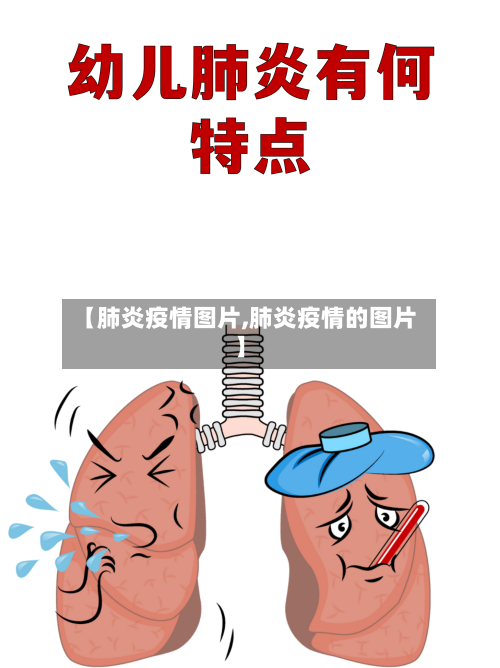 【肺炎疫情图片,肺炎疫情的图片】-第2张图片